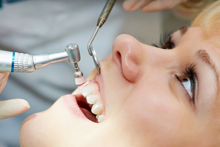 Prophylaxis (Dental Cleaning)